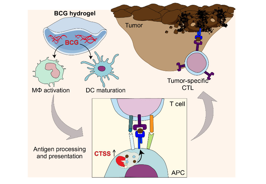 Behandlung von schwarzem Hautkrebs mit BCG-Hydrogel führt zu einer verbesserten Antigenverarbeitung und Präsentation von tumorassoziierten Antigenen, wodurch das Metastasierungspotenzial verringert und die Überlebensrate erhöht wird.