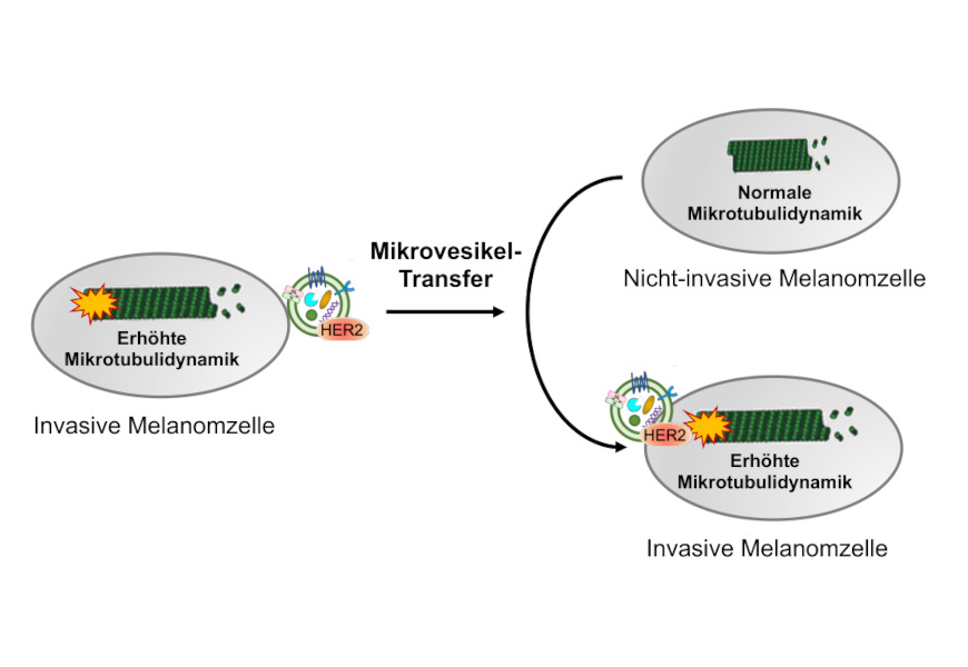 Das Ergebnis der Studie: eine erhöhte Dynamik von Mikrobuli vermittelt die Zellinvasivität von Melanomzellen und kann durch HER2-haltige Mikrovesikel von invasiven auf nicht-invasive Krebszellen übertragen werden.